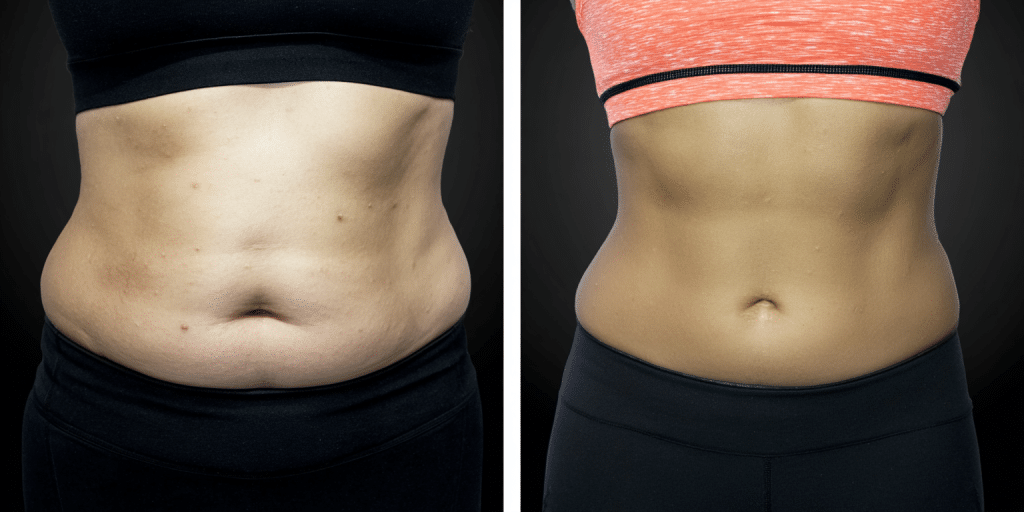 Abdomen