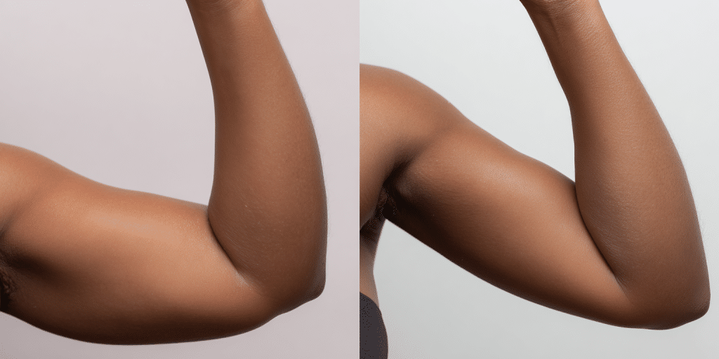 Arms
