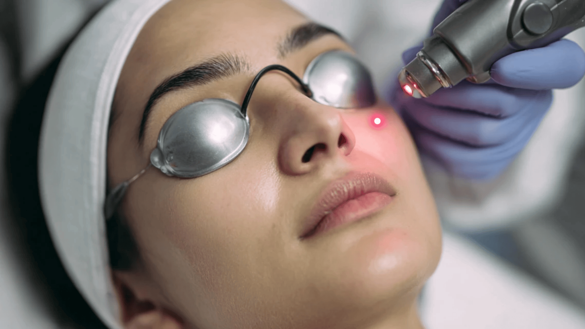 Laser+pigmentation+removal+(2)