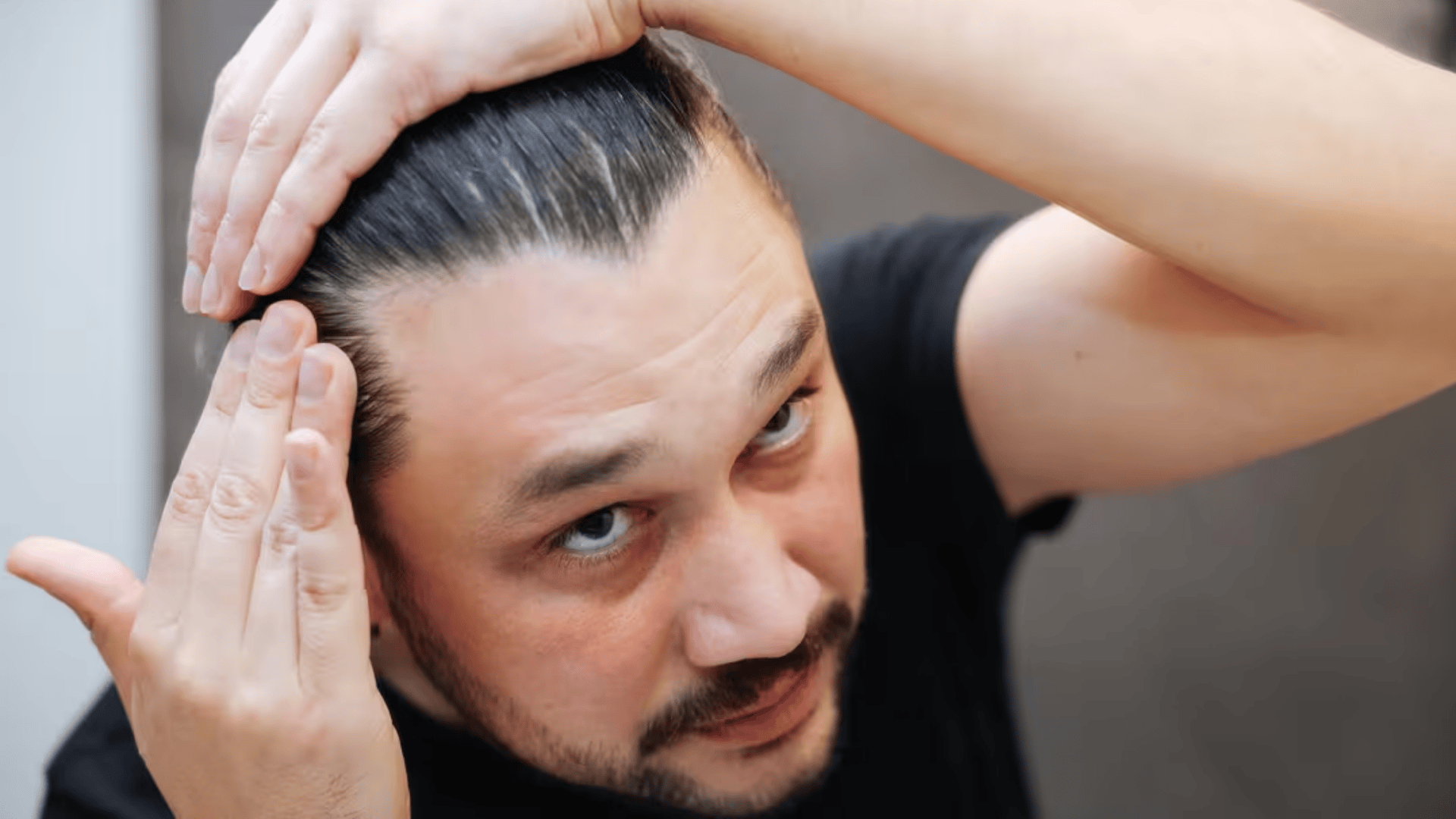 Can Dehydration Cause Hair Loss