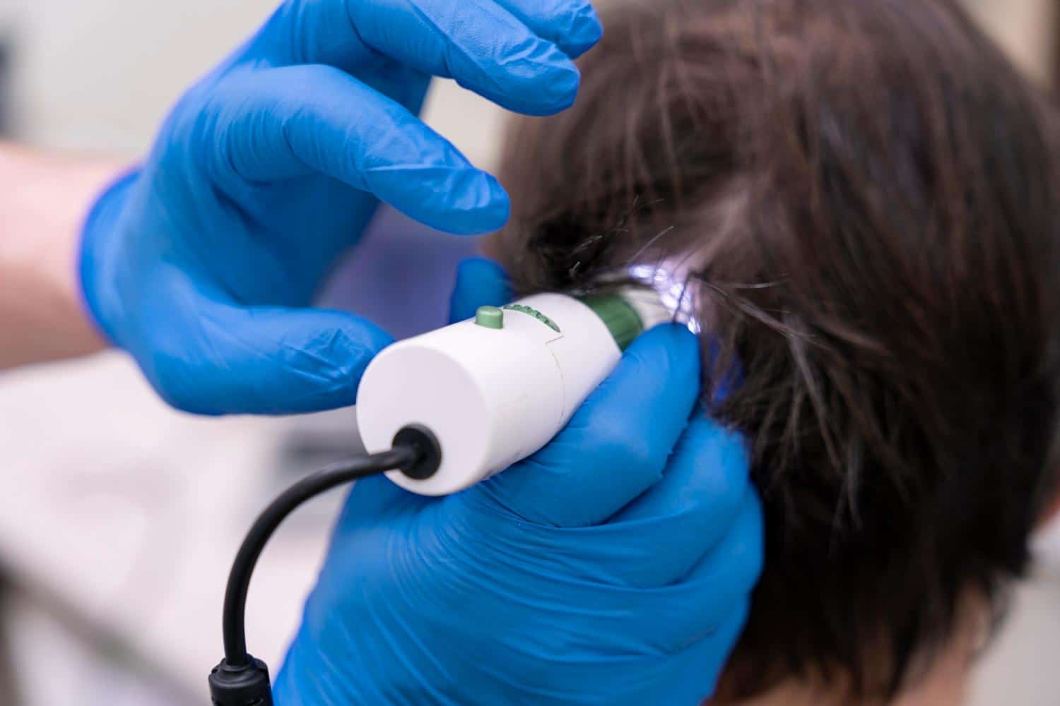 Which Is More Effective for Hair Growth: Laser or LED?