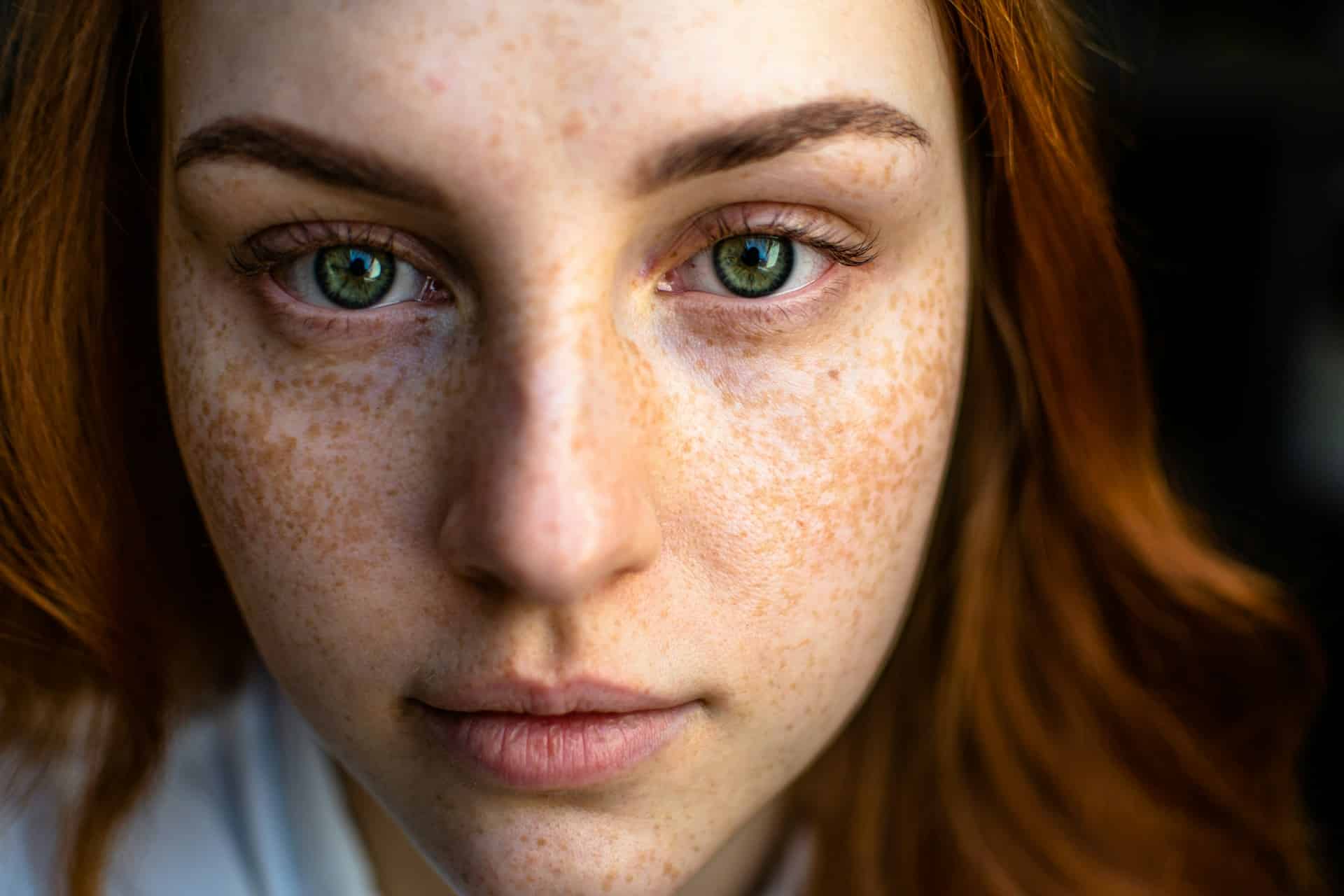 Why Do Adults with ADHD Pick Their Skin?