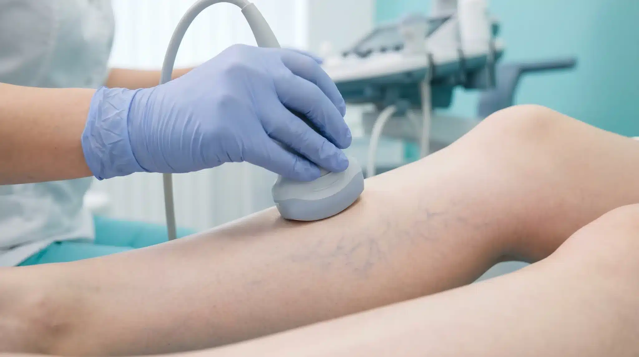 Ultrasound examination on patient's leg with varicose veins in medical clinic setting