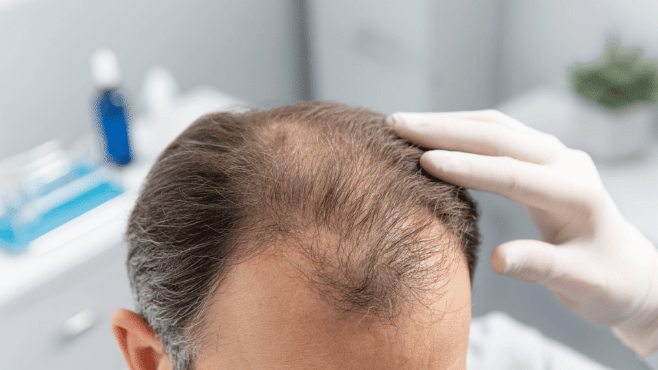 featured image- hair transplant infection