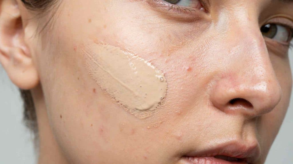 Close-up of foundation applied to skin, showing how heavy makeup formulas can clog pores and contribute to acne.