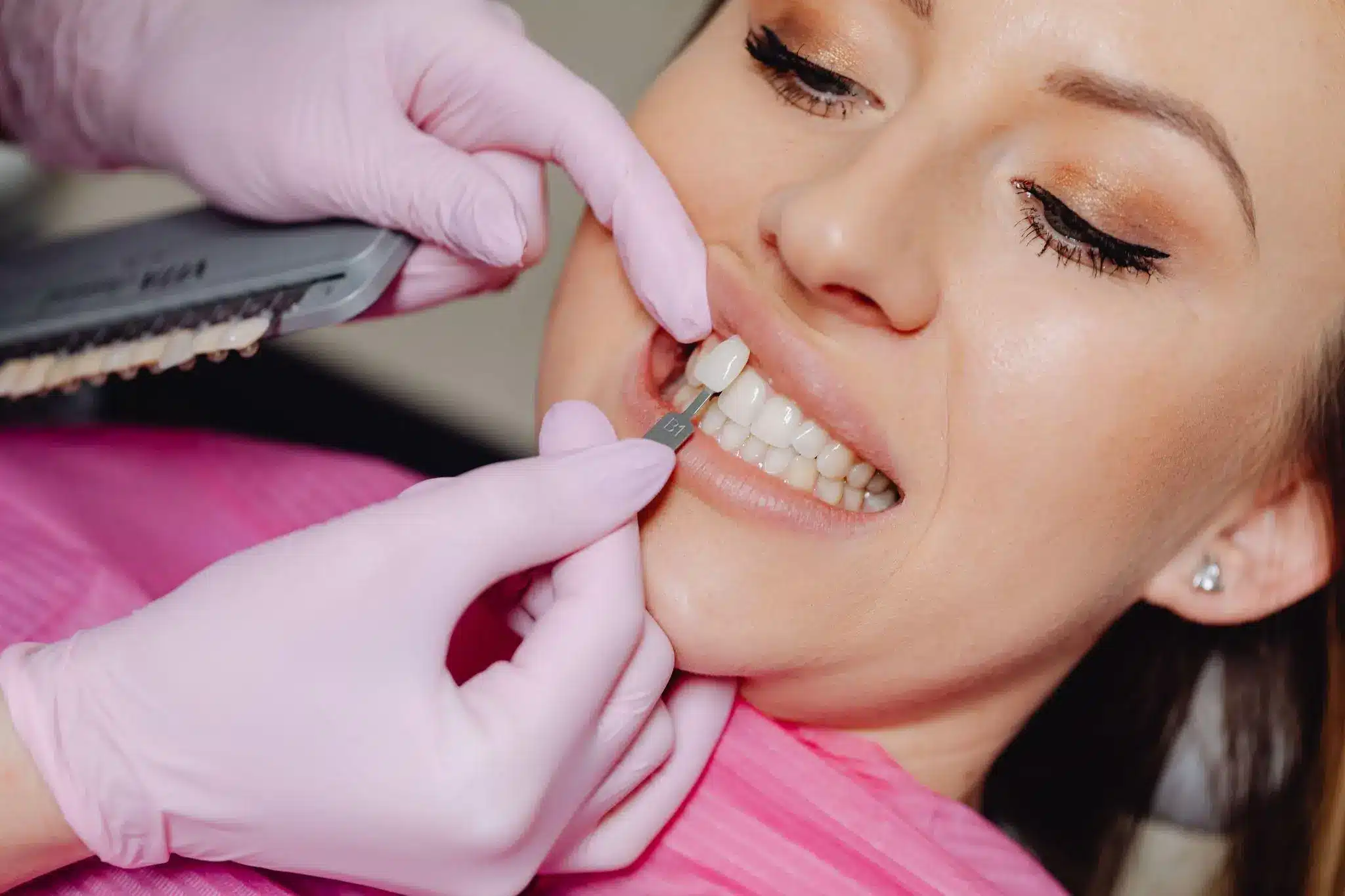 Dentist matching tooth shade for veneers on patient wearing pink dental bib
