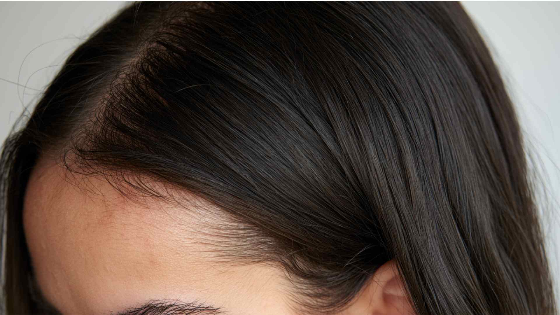 Mildly irritated scalp after applying a hair treatment