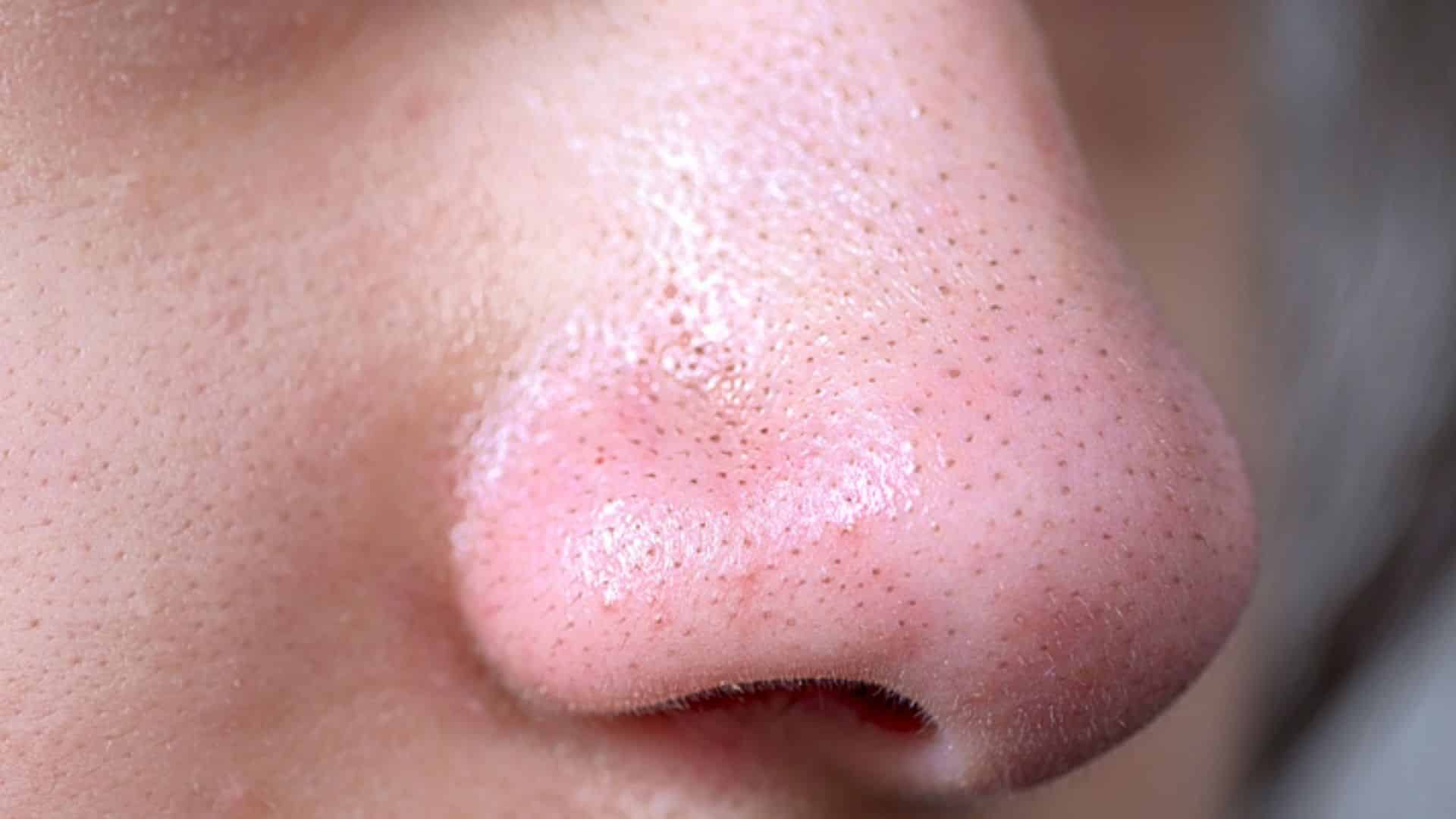 Close up of a nose showing visible sebaceous filaments as tiny dark dots across the pores and natural skin texture