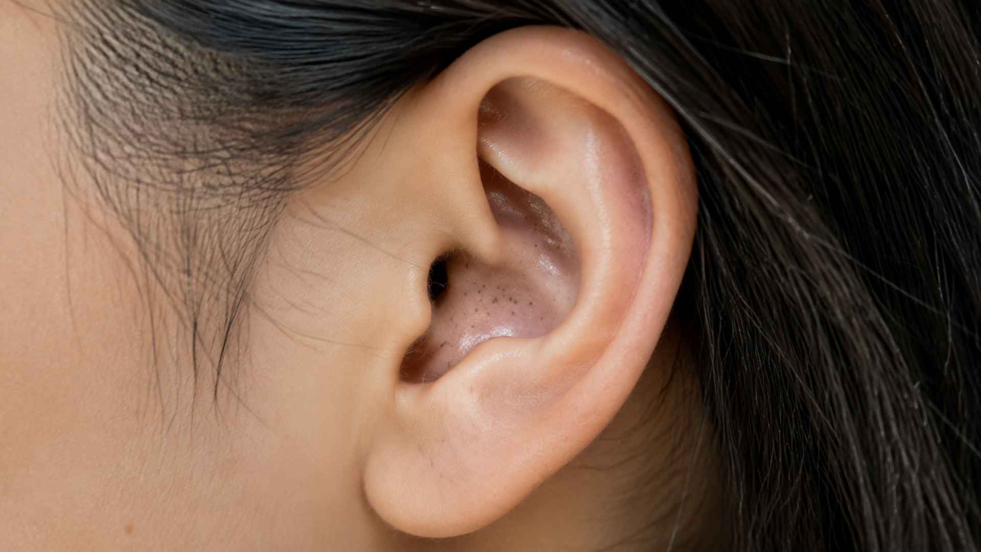Close up of a natural human ear showing a small blackhead on the outer ear with visible skin texture and soft lighting