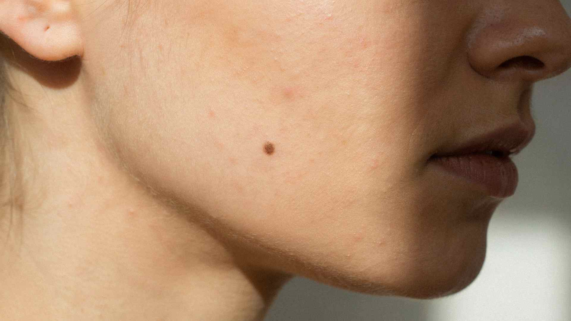 Close up of a natural dark beauty mark on a woman's cheek
